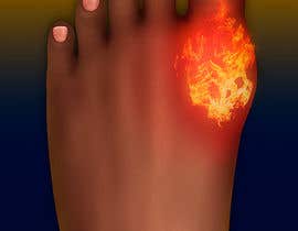 #14 for Image of a sore foot on fire (no photograph) by peshan