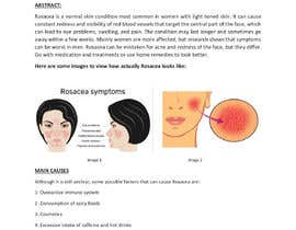 #23 for Write an 800-word blog post titled &quot;IPL vs Laser Treatments for Rosacea&quot; af sadiaarsalan21