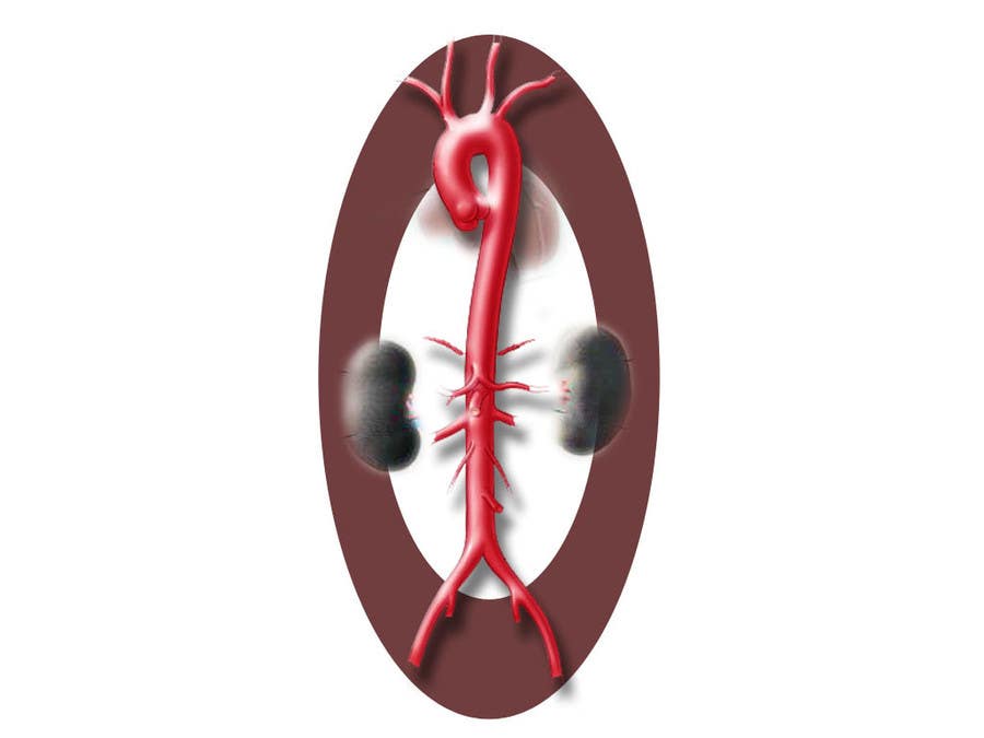 Inscrição nº 20 do Concurso para                                                 I need some Graphic Design for the anatomy of the abdominal/thoracic aorta
                                            
